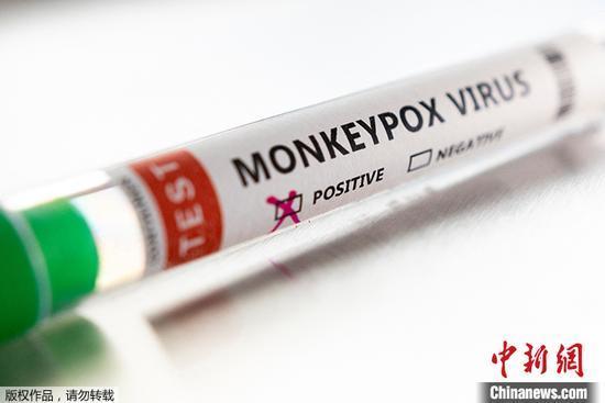 全美已有超1.4萬例猴痘病例 紐約州報告首例未成年病例