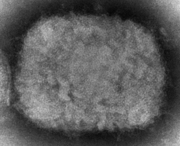 美媒：世界卫生组织计划重新命名猴痘