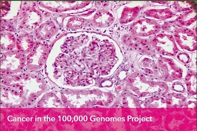 大型全基因组分析揭示罕见致癌突变