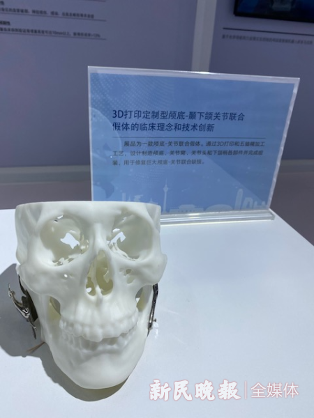 图说：3D打印定制型颅底
