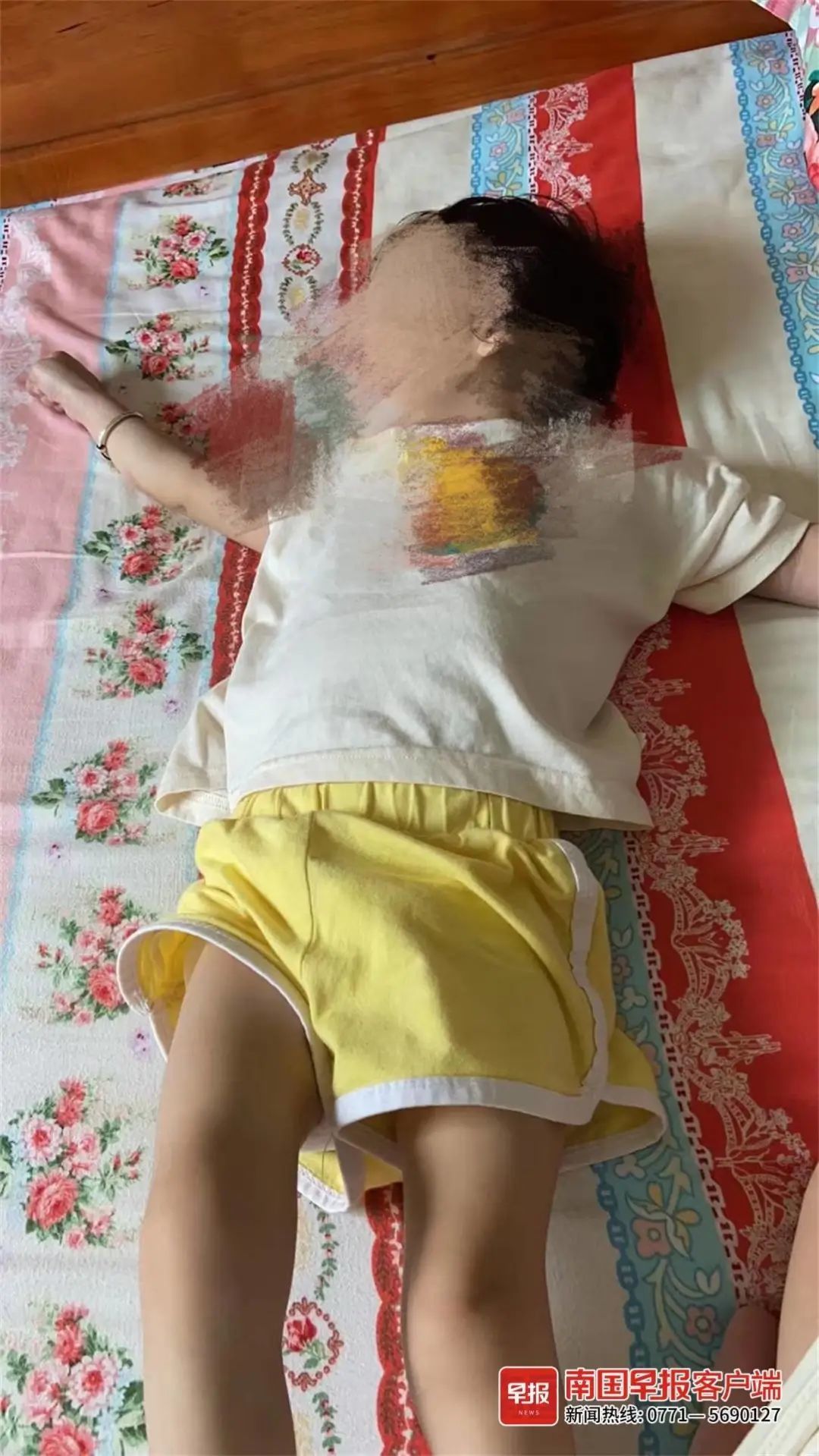 “南丹县”广西女婴出生时重度窒息致脑瘫，当事医院被判赔近62万元