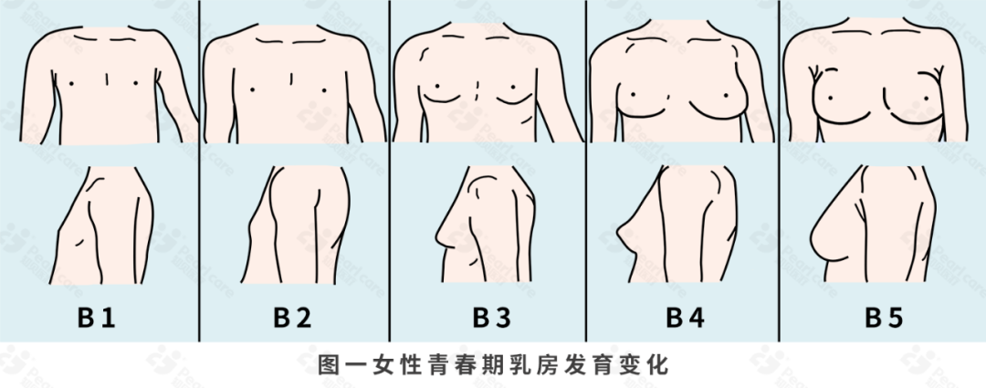 乳房作为女性其中一个性征,从儿童期到成年期按照女孩乳房发育性成熟